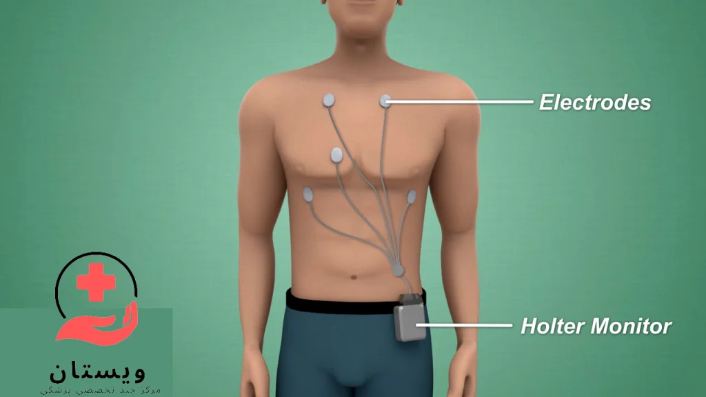 هولتر ضربان قلب؛ کاربرد، نحوه نصب و تفسیر نتایج