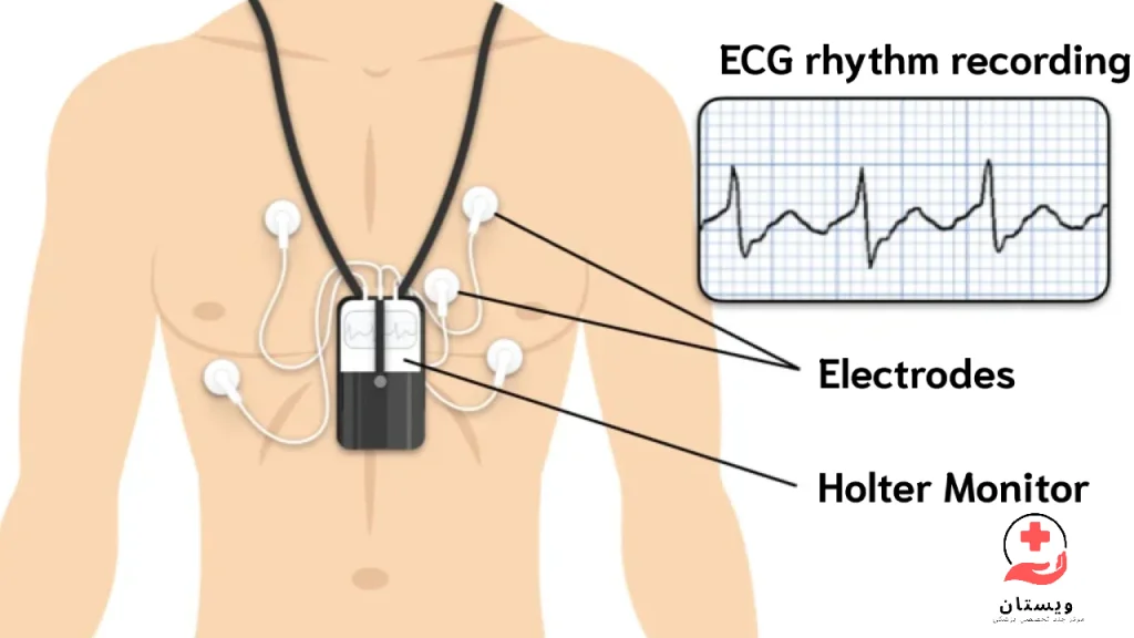 نمای اینفوگرافیکی از هولتر قلب