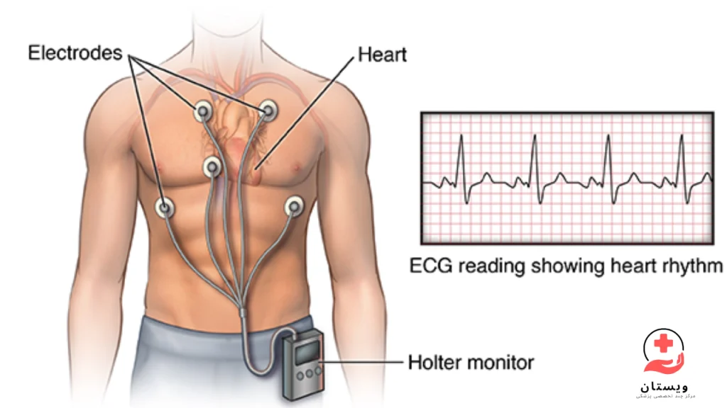 نمای اینفوگرافیکی از هولتر 24 ساعته قلب