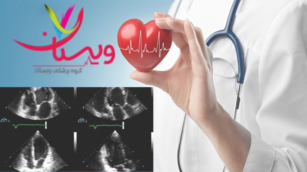 اکو قلب با بیمه سلامت تنها در مراکز طرف قرارداد معتبر انجام میشود.