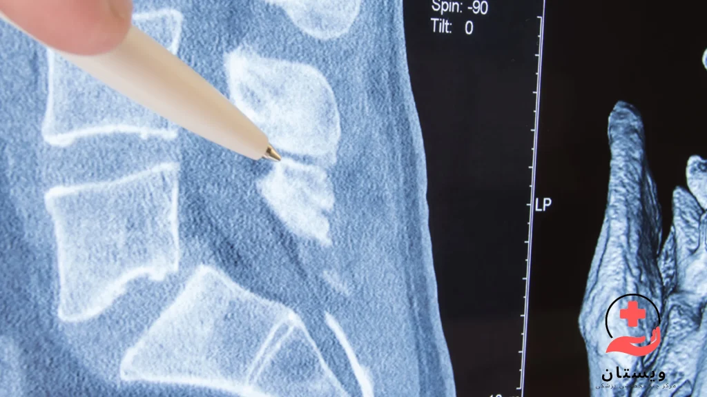 بررسی ام آر آی توسط پزشک