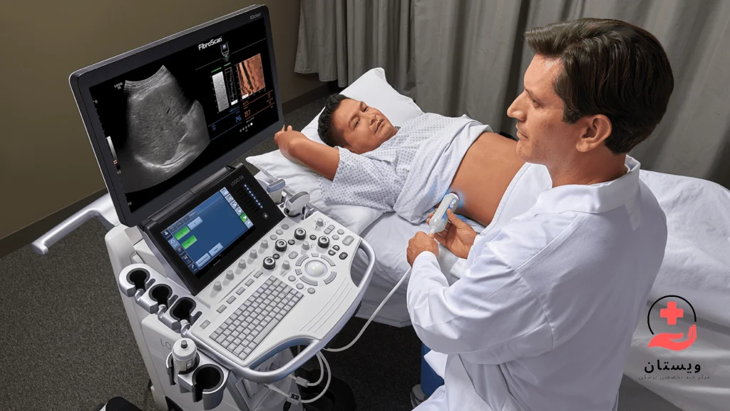 فیبرو اسکن کبد چیست و چگونه انجام میشود؟ + تفسیر نتیجه