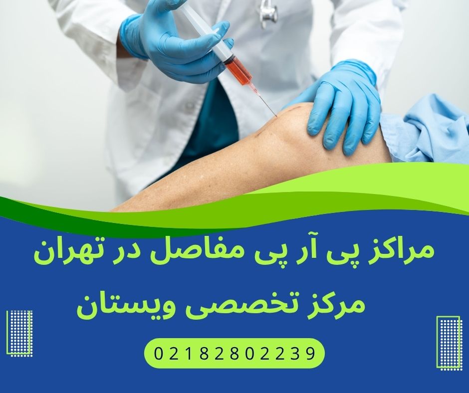 مراکز پی آر پی مفاصل تهران