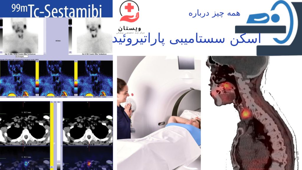 تصاویر مرتبط با اسکن سستامیبی پاراتیروئید