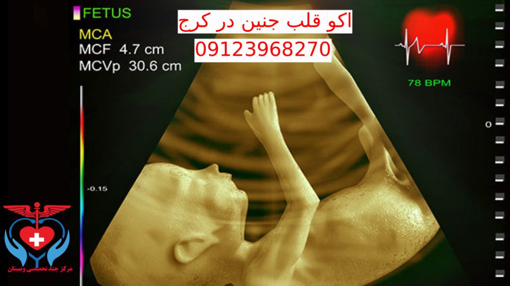 اکو جنین کرج تصویری از اکو قلب جنین