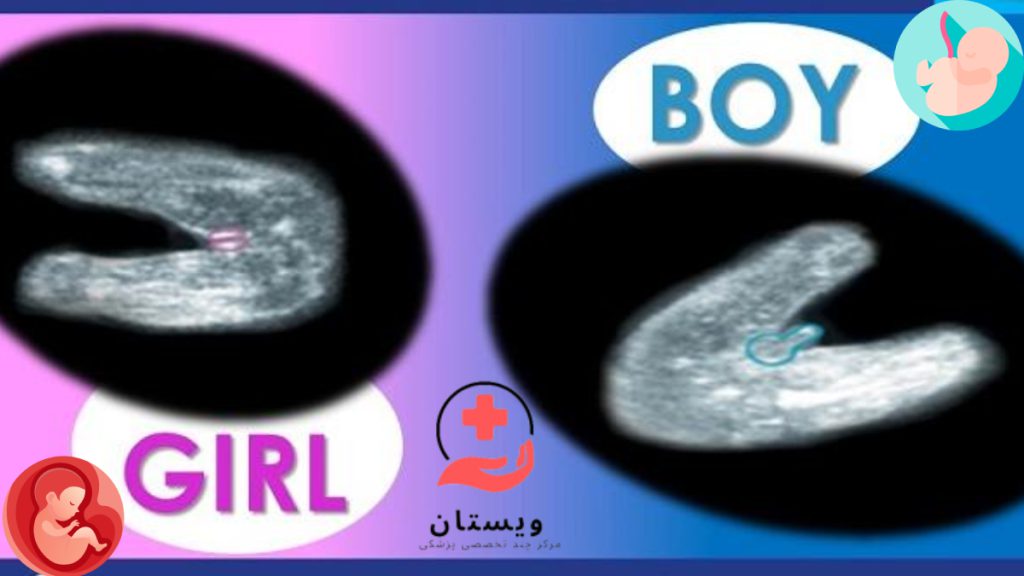 سونوی انومالی جنین پسر و دختر تصویری از نحوه تشخیص جنسیت جنین در سونوی آنومالی هفته 18 بارداری