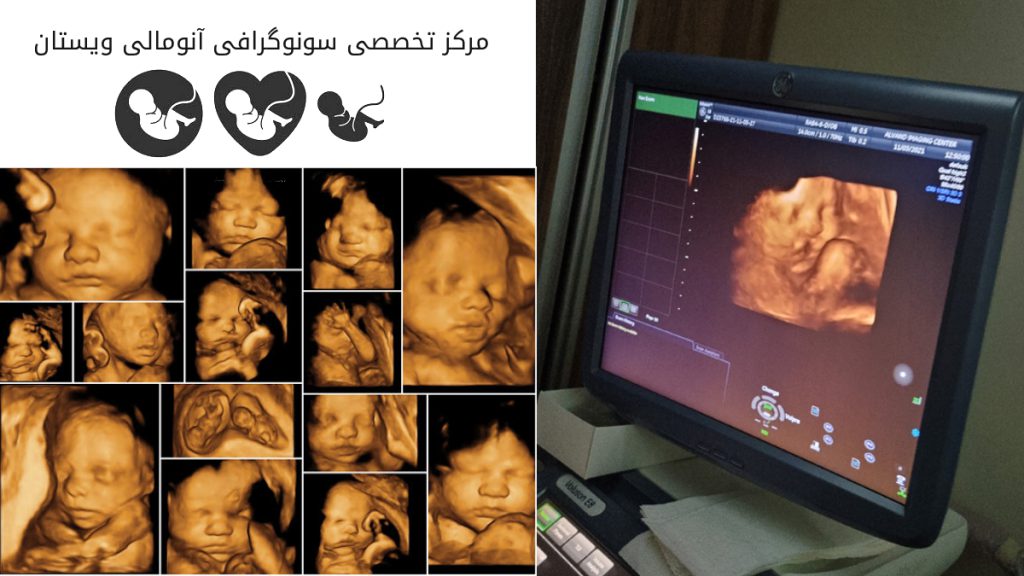 بهترین مرکز سونوگرافی آنومالی بهترین مرکز سونوی آنومالی در تهران - تصاویری از سونوی آنومالی جنین در هفته 20 مرکز ویستان