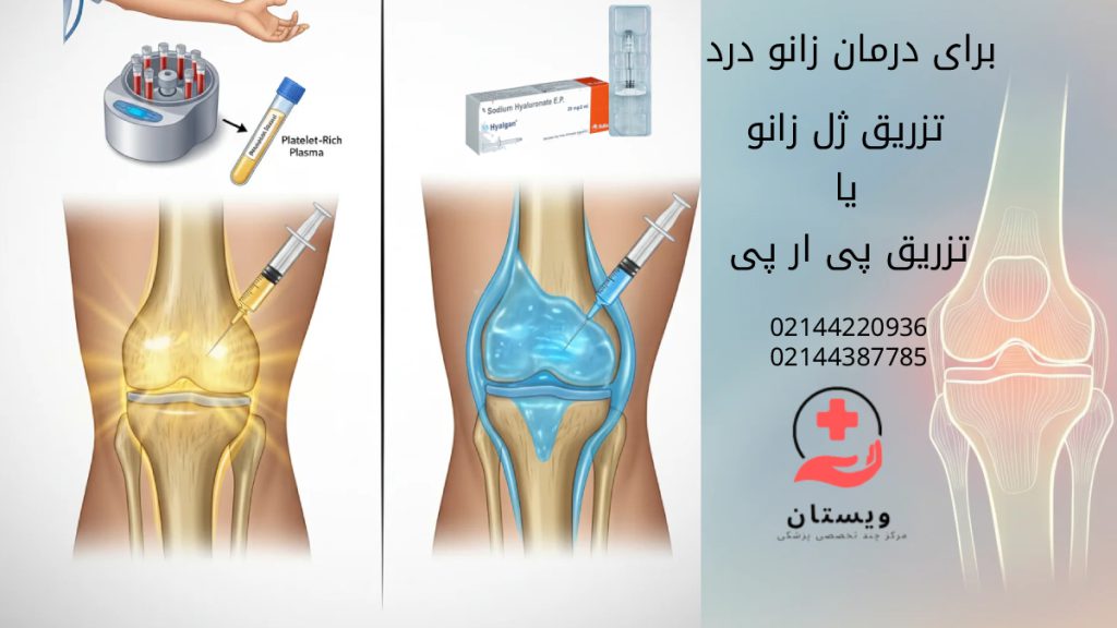 تزریق ژل به زانو بهتر است یا تزریق پی ار پی به زانو