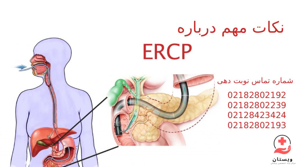 همه چیز درباره روش ERCP