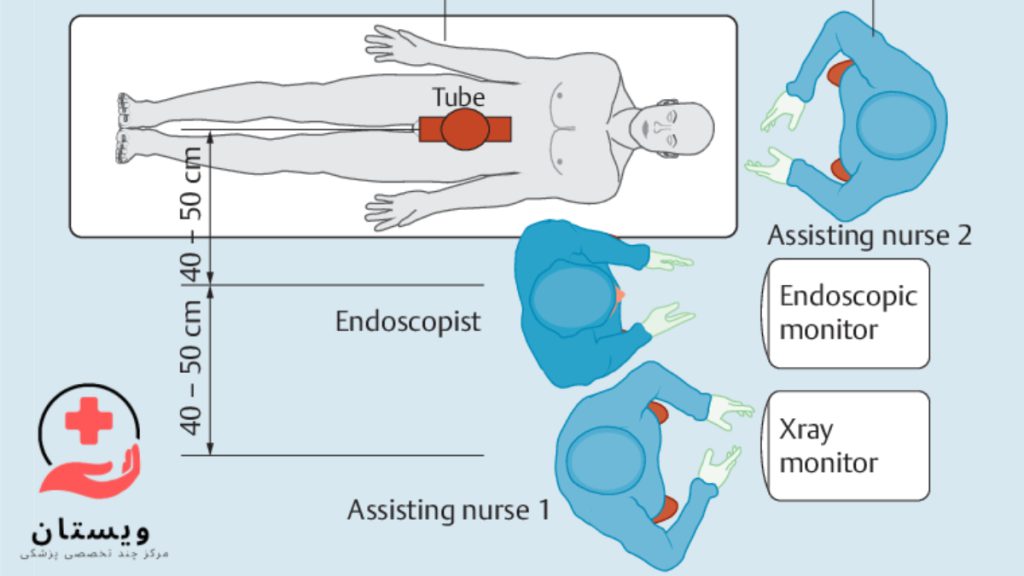 نحوه انجام ERCP نحوه انجام ای ار سی پی توسط تکنسین و پرستارهای بخش