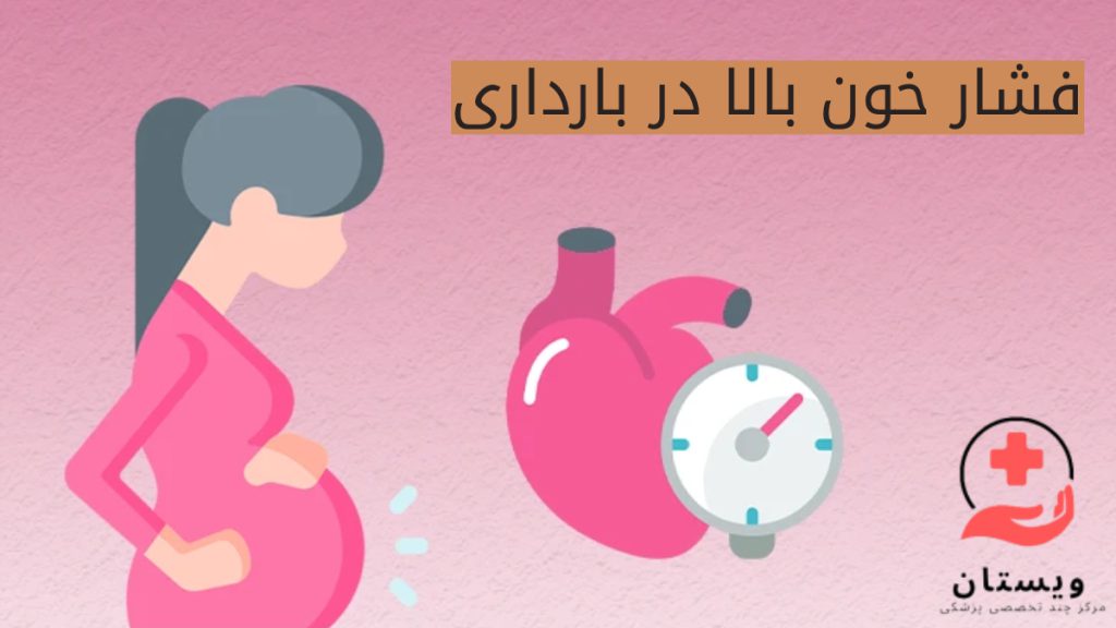 زایمان زودرس به علت فشارخون بالا فشار خون بالا در بارداری