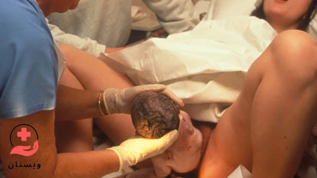 عکس زایمان طبیعی تصویری از یک مادر در حال زایمان طبیعی