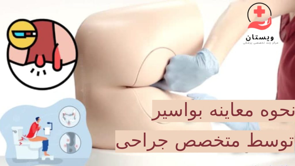 معاینه هموروئید نحوه معاینه همورویید یا بواسیر توسط متخصص جراحی