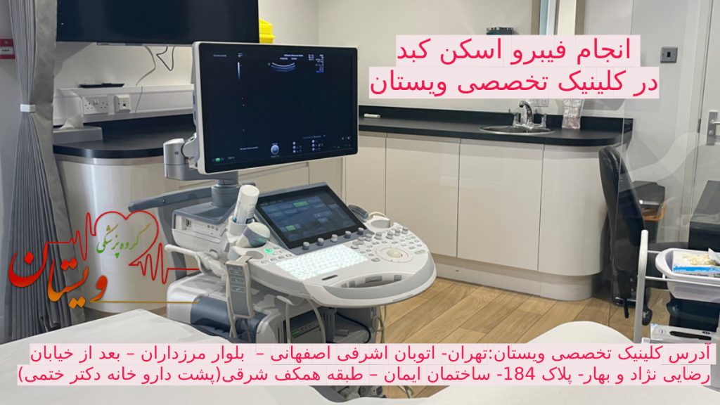 فیبرواسکن کبد تصویری از دستگاه فیبرواسکن کبد برای تشخیص کبد چرب در کلینیک ویستان مرزداران