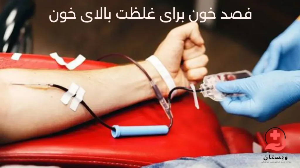 فصد خون و غلظت خون تصویری از فصد خون برای فردی که غلظت خون بالا دارد