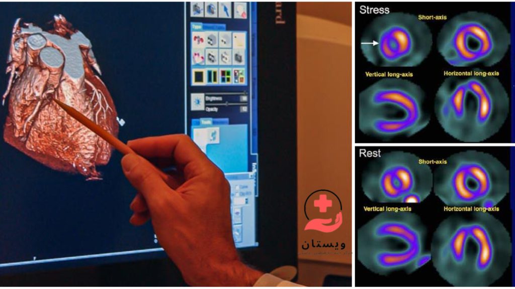 تصویر اسکن رنگی قلب پزشک در حال اشاره به قلب و تصاویری از اسکن قلب در سمت دیگر تصویر
