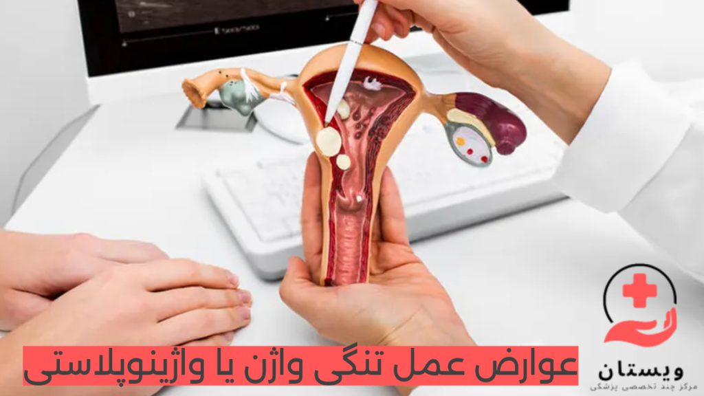 عوارض عمل تنگی واژن پزشک در حال شرح آناتومی واژن به بیمار برای عوارض احتمالی واژینوپلاستی یا عمل تنگی واژن