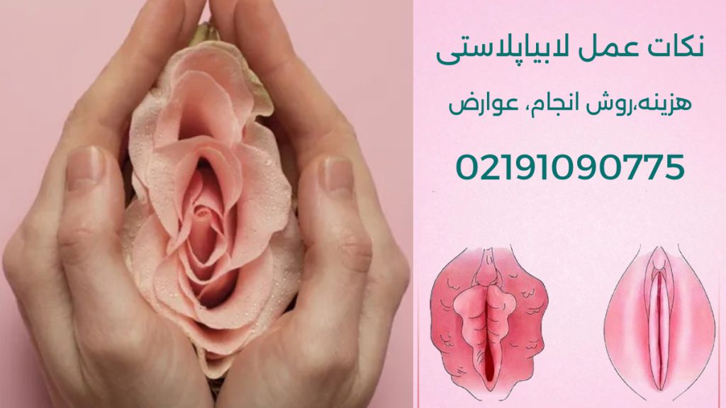هزینه عمل لابیاپلاستی= عمل زیبایی واژن - یک گل در دست دختر نماد زیبایی زنانه