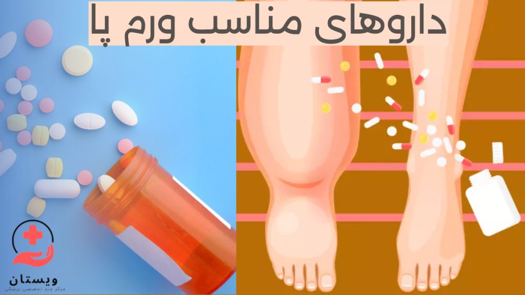 بهترین قرص ورم پا چیست؟ تصویر انیمیشنی از ورم پای راست - تصویر دارو و قرص برای درمان ادم پا یا ورم پا