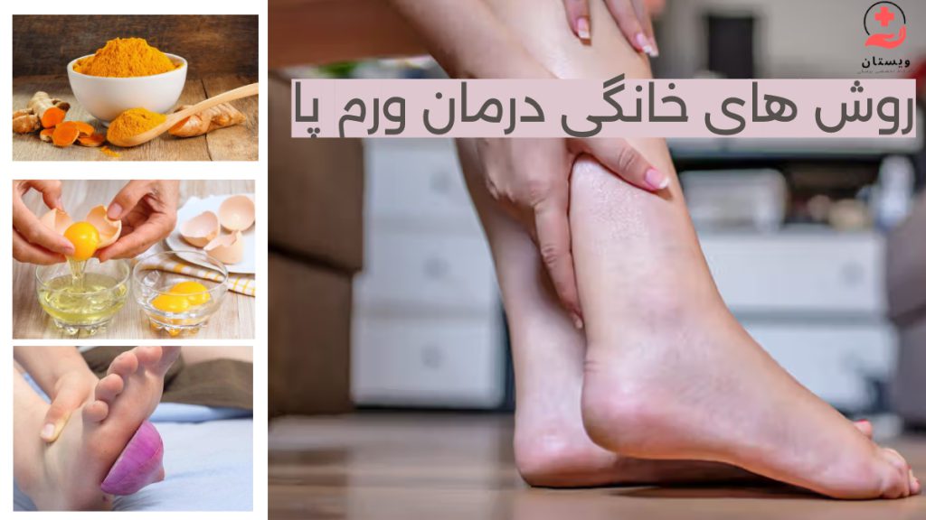 درمان خانگی ورم پا زنی که پای ورم کرده خود را در دست گرفته و تصویر زردچوبه و زرده تخم و مرغ و پیای روی ورم پا برای درمان