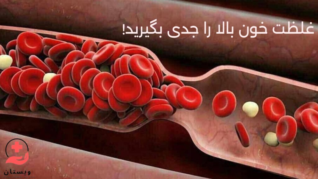 نکات مهم درباره غلظت خون بالا - تصویری از هجوم گلبول های قرمز داخل رگ