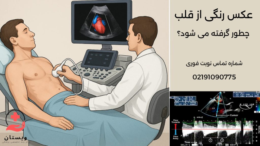 بیمار با زاویه حدود ۳۰ درجه به چپ دراز کشیده، تکنسین روی صندلی در فاصله مناسب نشسته و پروب را روی سمت چپ قفسه سینه قرار داده است. مانیتور روبهروی تکنسین است و تصویر داپلر رنگی قلب با جریانهای قرمز و آبی واضح دیده میشود.