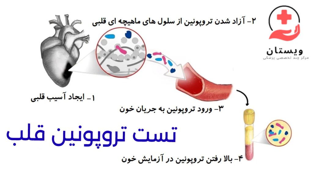 آزمایش تروپونین خون در تصویر مراحل رفتن میزان تروپونین در خون بعد از آسیب به عضله قلب رسم شده است.