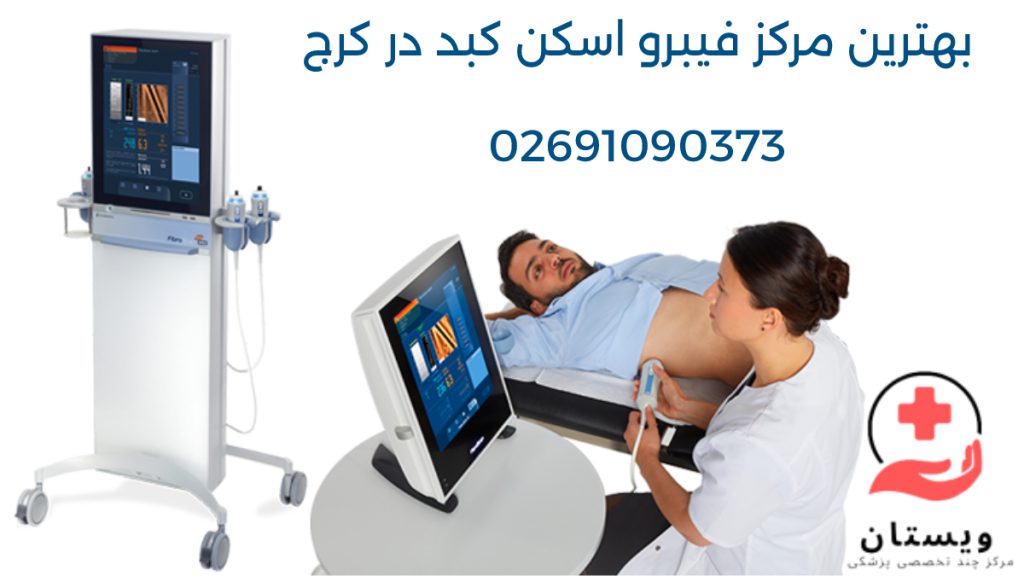 مرکز فیبرو اسکن کبد در کرج - 02691090373