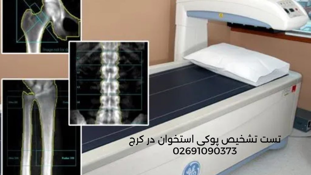 DEXA BONE DENSITOMETRY تصویری از جواب تراگم استخوان لگن و شانه و ستون فقرات به همراه دستگاه تراکم استخوان