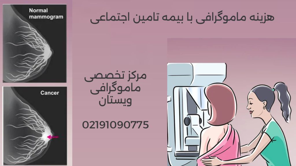 هزینه ماموگرافی با بیمه تامین اجتماعی 1404 + مراکز ماموگرافی رایگان