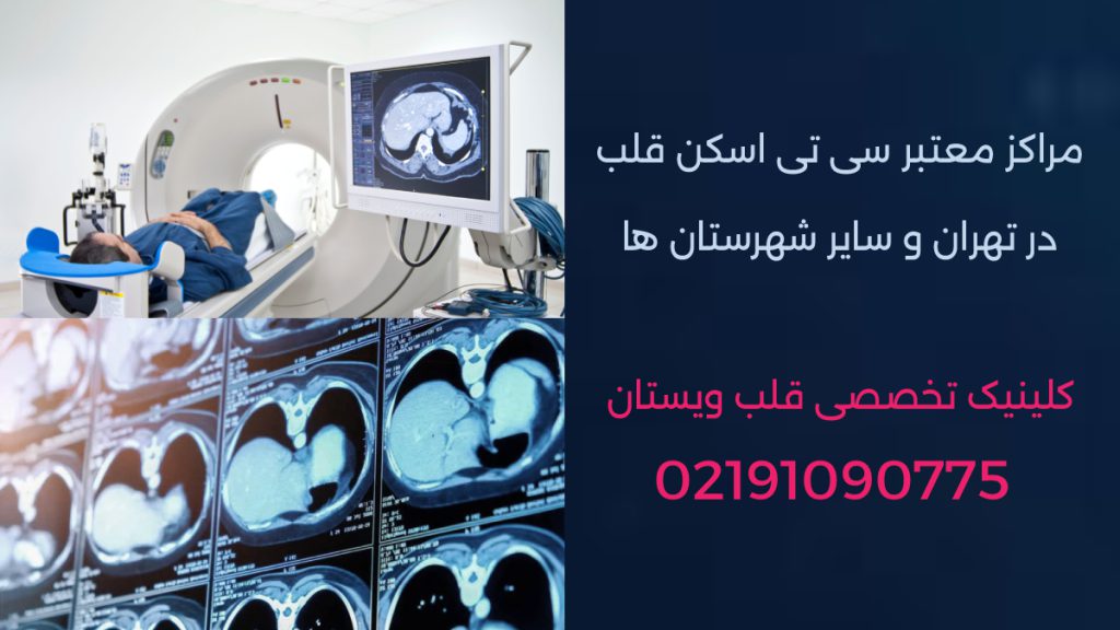 تصویری از بیمار در حال انجام سی تی اسکن قلب و جواب سی تی قلب
