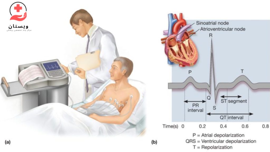 ecg در میوکاردیت تصویری از گرفتن نوار قلب در بیمار میوکاردیت