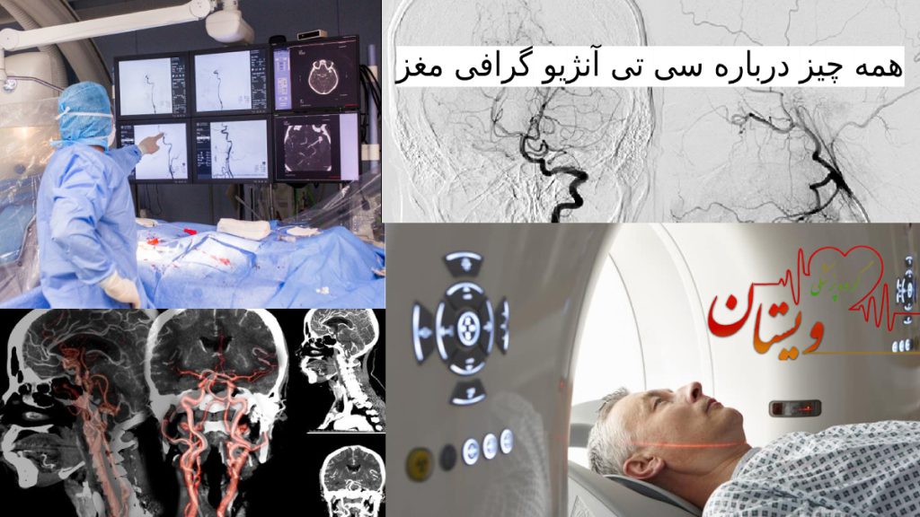 تصاویری مربوط به سی تی انژیو مغز ، جواب سی تی انژیوگرافی مغز و دستگاه آن