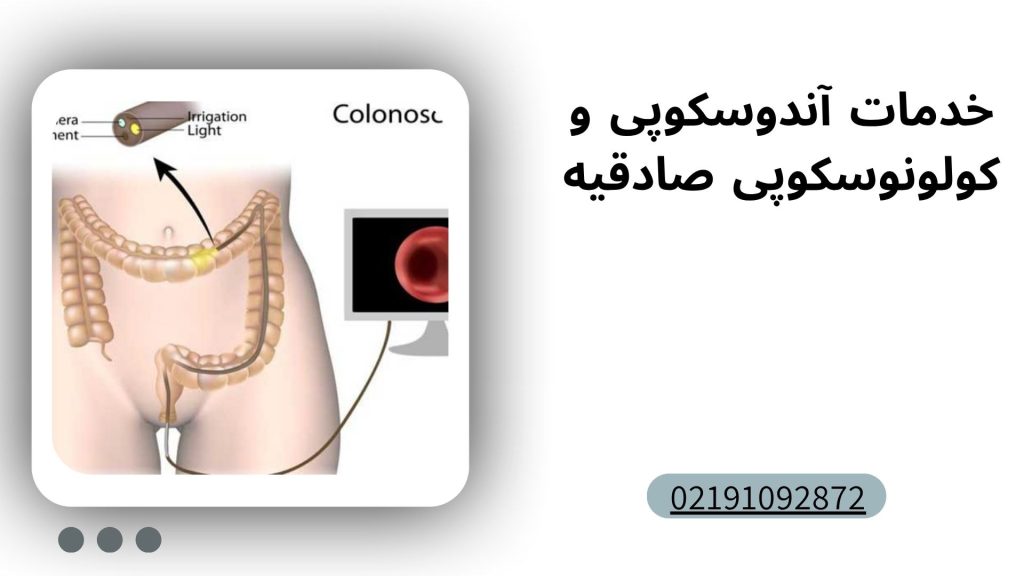 خدمات آندوسکوپی و کولونوسکوپی صادقیه تهران