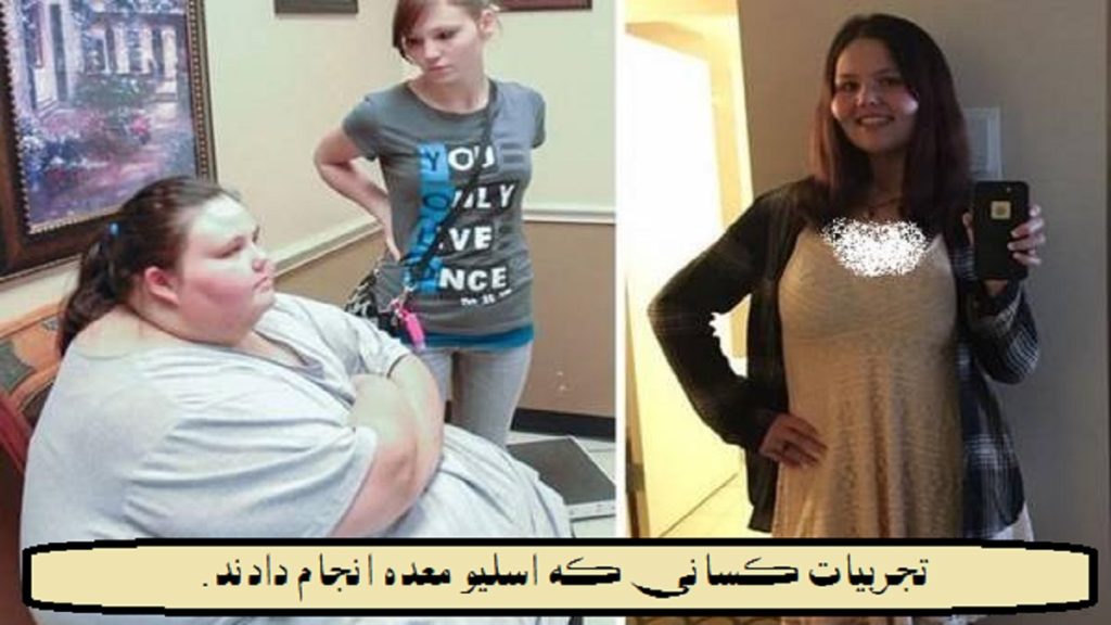 نظرات کسانی که عمل اسلیو انجام دادند