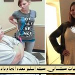 نظرات کسانی که عمل اسلیو انجام دادند