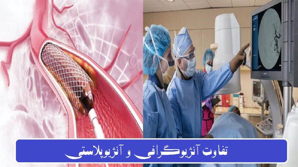 تفاوت آنژیوگرافی و آنژیوپلاستی در چیست؟