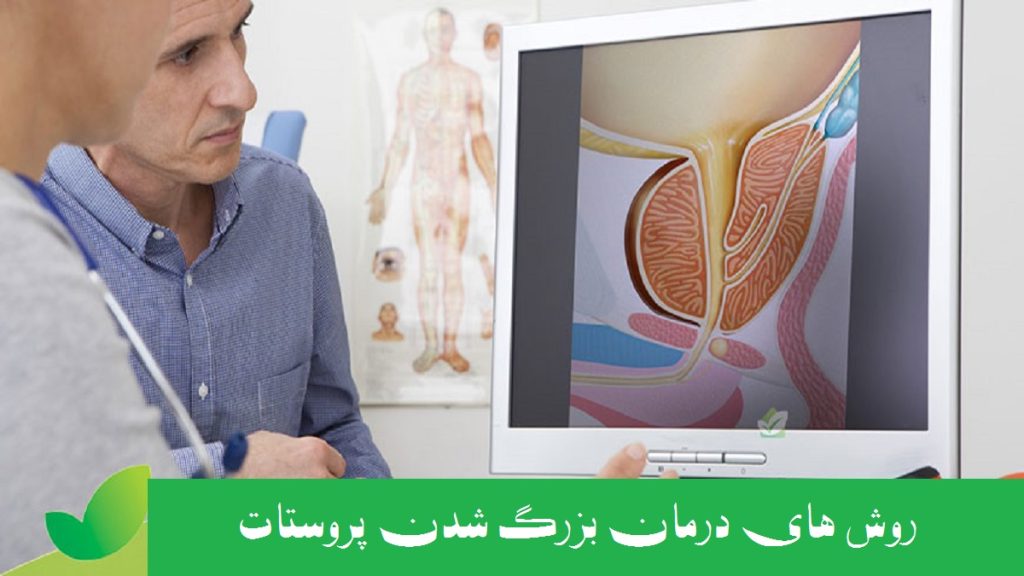 درمان پروستات