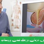 درمان پروستات