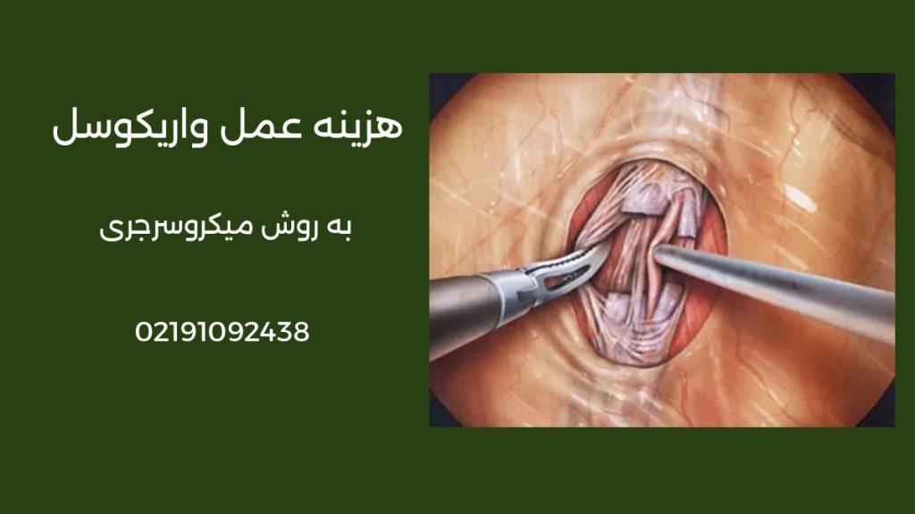 هزینه جراحی واریکوسل با لیزر سال 1405 در تهران | آزاد و بیمه
