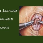 هزینه جراحی واریکوسل با لیزر سال 1405 در تهران | آزاد و بیمه