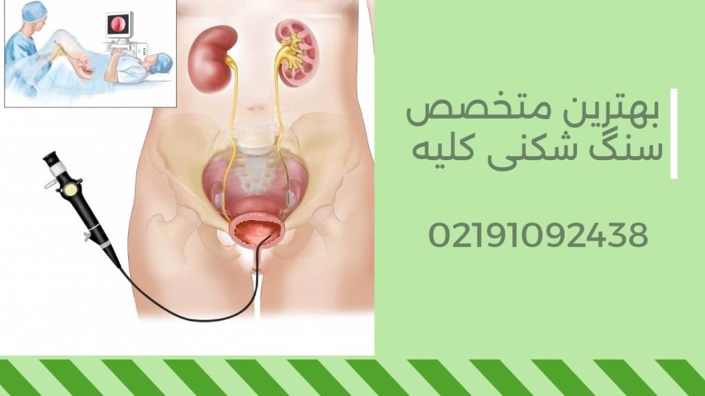 بهترین دکتر سنگ شکنی کلیه تهران|معرفی بهترین اورولوژیست خانم 1405