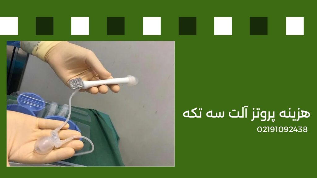 هزینه پروتز آلت سه تکه در سال 1405 تصویری از پروتز آلت