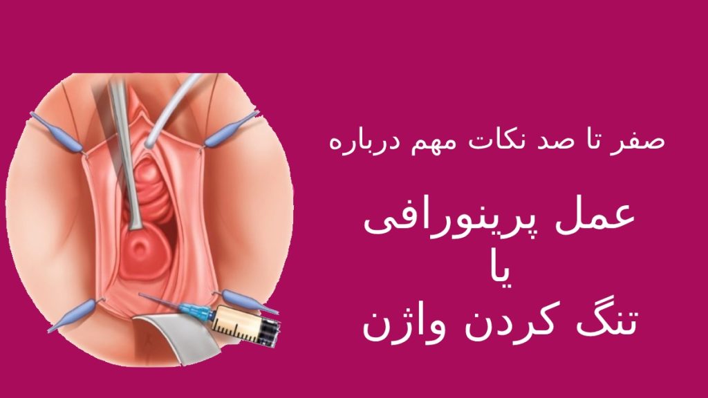 صفرتا صد نکات عمل پرینورافی واژن