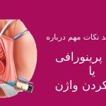 صفرتا صد نکات عمل پرینورافی واژن
