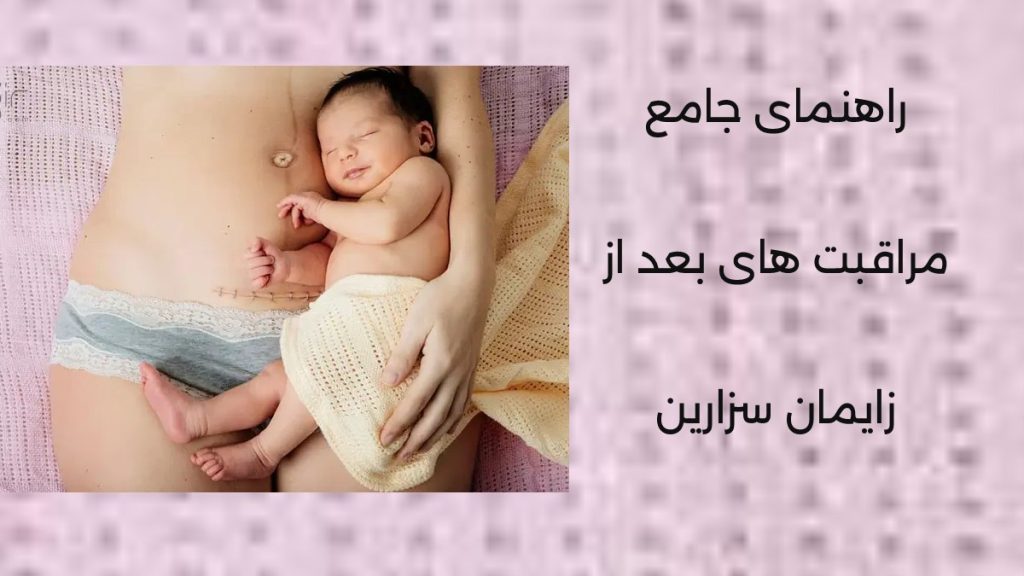 مراقبت های بعد از زایمان سزارین