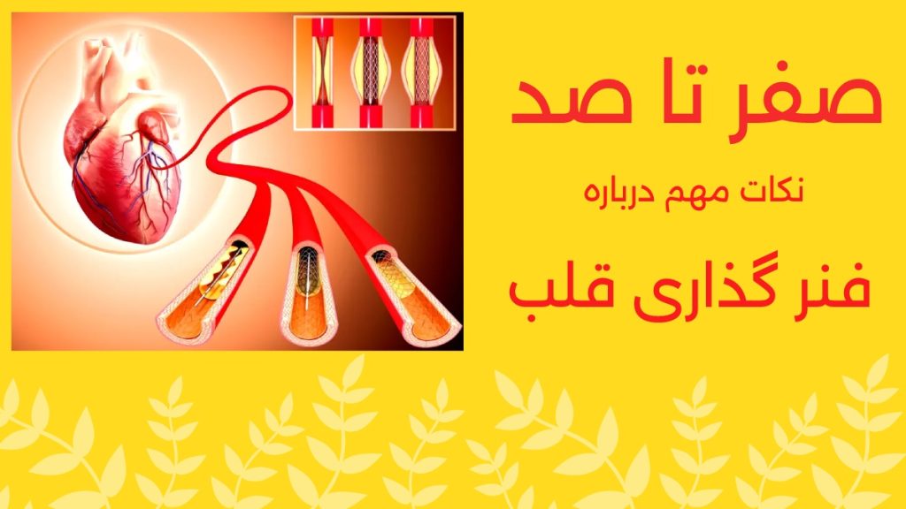 فنر گذاری قلب چیست؟ تصویر شماتیک از استنت گذاری قلب یا آنژیوپلاستی