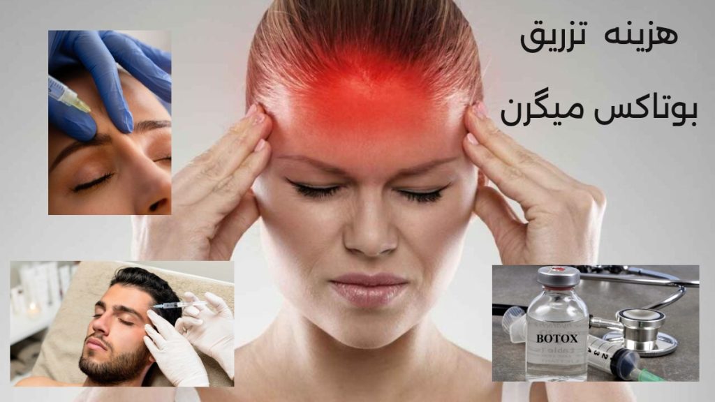 هزینه بوتاکس میگرن چقدر است؟