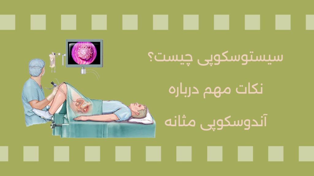 سیستوسکوپی چیست؟ سیستوسکوپی به انگلیسی