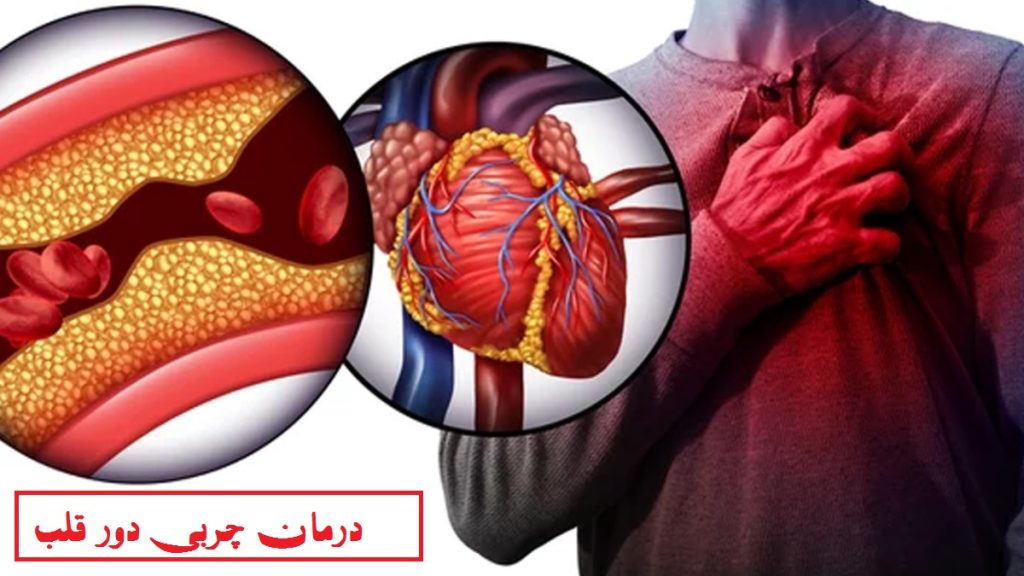 راه های درمان چربی دور قلب با دارو و طب سنتی